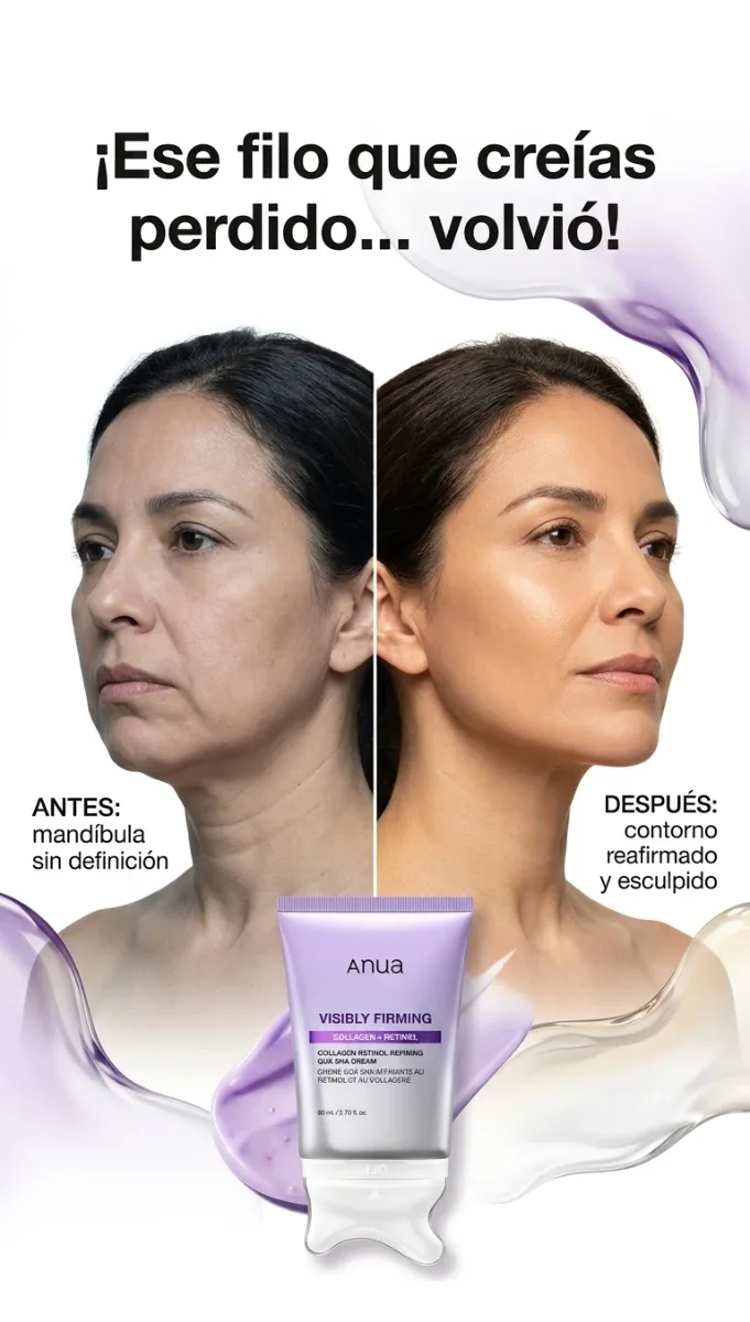Antes y Después